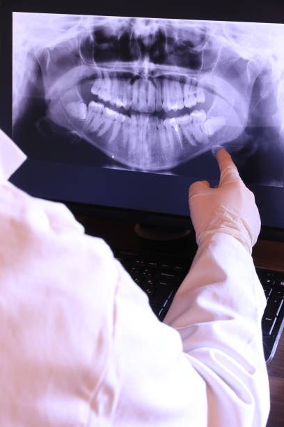 Best Broken or Chipped Tooth Repair in Sewaren, NJ