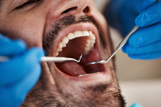 Best Urgent Dental Care for Toothaches in Sewaren, NJ